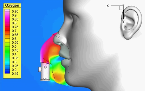 Simulação computacional acelera desenvolvimento de pesquisas sobre a Covid-19 e projetos de respiradores artificiais  - Imagem: Divulgação
